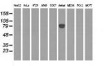 EPM2AIP1 Antibody in Western Blot (WB)