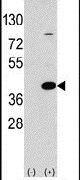 EPM2A Antibody in Western Blot (WB)