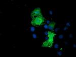 EPN2 Antibody in Immunocytochemistry (ICC/IF)