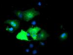EPN2 Antibody in Immunocytochemistry (ICC/IF)
