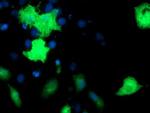 EPN2 Antibody in Immunocytochemistry (ICC/IF)