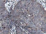 EPN2 Antibody in Immunohistochemistry (Paraffin) (IHC (P))
