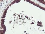 EPN2 Antibody in Immunohistochemistry (Paraffin) (IHC (P))
