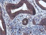 EPN2 Antibody in Immunohistochemistry (Paraffin) (IHC (P))
