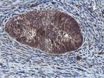 EPN2 Antibody in Immunohistochemistry (Paraffin) (IHC (P))