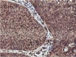 EPN2 Antibody in Immunohistochemistry (Paraffin) (IHC (P))