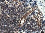 EPN2 Antibody in Immunohistochemistry (Paraffin) (IHC (P))