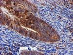EPN2 Antibody in Immunohistochemistry (Paraffin) (IHC (P))