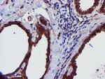 EPN2 Antibody in Immunohistochemistry (Paraffin) (IHC (P))