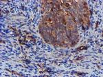 EPN2 Antibody in Immunohistochemistry (Paraffin) (IHC (P))