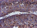 EPN2 Antibody in Immunohistochemistry (Paraffin) (IHC (P))