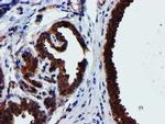 EPN2 Antibody in Immunohistochemistry (Paraffin) (IHC (P))