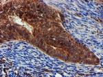 EPN2 Antibody in Immunohistochemistry (Paraffin) (IHC (P))