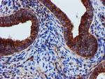 EPN2 Antibody in Immunohistochemistry (Paraffin) (IHC (P))