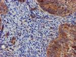 EPN2 Antibody in Immunohistochemistry (Paraffin) (IHC (P))