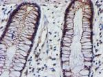 EPN2 Antibody in Immunohistochemistry (Paraffin) (IHC (P))