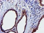 EPN2 Antibody in Immunohistochemistry (Paraffin) (IHC (P))