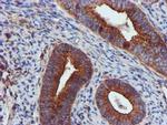 EPN2 Antibody in Immunohistochemistry (Paraffin) (IHC (P))