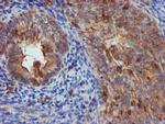 EPN2 Antibody in Immunohistochemistry (Paraffin) (IHC (P))