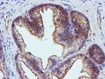 EPN2 Antibody in Immunohistochemistry (Paraffin) (IHC (P))