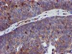 EPN2 Antibody in Immunohistochemistry (Paraffin) (IHC (P))