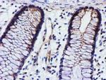 EPN2 Antibody in Immunohistochemistry (Paraffin) (IHC (P))