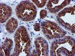 EPN2 Antibody in Immunohistochemistry (Paraffin) (IHC (P))