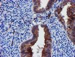 EPN2 Antibody in Immunohistochemistry (Paraffin) (IHC (P))