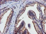 EPN2 Antibody in Immunohistochemistry (Paraffin) (IHC (P))