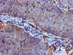 EPN2 Antibody in Immunohistochemistry (Paraffin) (IHC (P))
