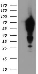 EPN2 Antibody in Western Blot (WB)