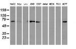EPN2 Antibody in Western Blot (WB)
