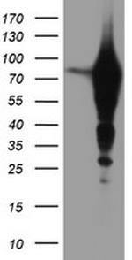 EPN2 Antibody in Western Blot (WB)