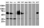 EPN2 Antibody in Western Blot (WB)