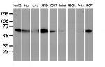 EPN2 Antibody in Western Blot (WB)