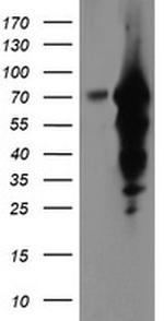 EPN2 Antibody in Western Blot (WB)