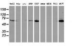 EPN2 Antibody in Western Blot (WB)