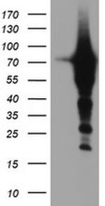 EPN2 Antibody in Western Blot (WB)