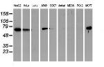 EPN2 Antibody in Western Blot (WB)