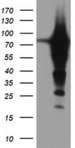 EPN2 Antibody in Western Blot (WB)