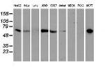 EPN2 Antibody in Western Blot (WB)