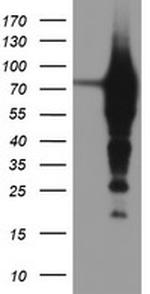 EPN2 Antibody in Western Blot (WB)