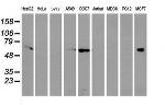 EPN2 Antibody in Western Blot (WB)