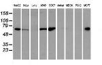 EPN2 Antibody in Western Blot (WB)