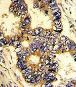 Epsin 3 Antibody in Immunohistochemistry (IHC)