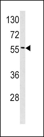 Epsin 3 Antibody in Western Blot (WB)