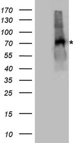 EPOR Antibody in Western Blot (WB)