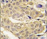 EPRS Antibody in Immunohistochemistry (IHC)