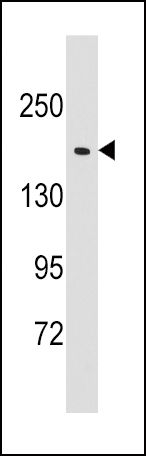 EPRS Antibody in Western Blot (WB)