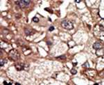 EPS8 Antibody in Immunohistochemistry (IHC)